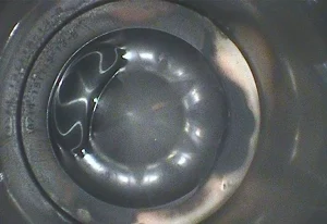 Borescope providing a clear view of a CAT yacht engine's internal components.